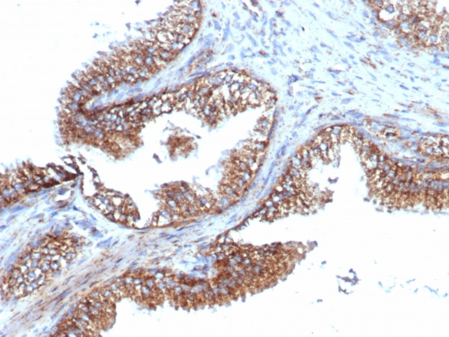 PMEPA1/TMEPAI (Tumor Suppressor Oncoprotein) Antibody in Immunohistochemistry (Paraffin) (IHC (P))