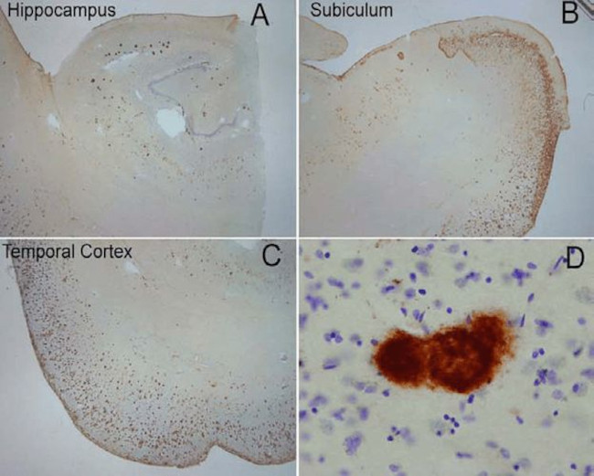 Amyloid Fibrils Antibody in Immunohistochemistry (IHC)