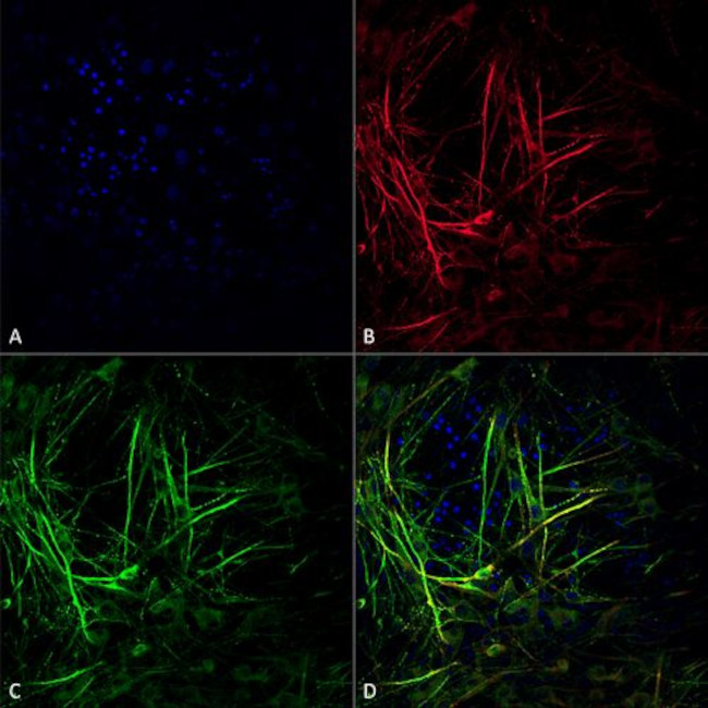 Tau Antibody in Immunocytochemistry (ICC/IF)