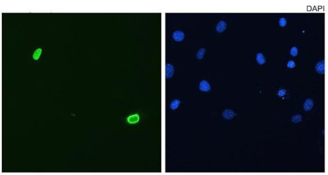 DUX4 Antibody in Immunocytochemistry (ICC/IF)