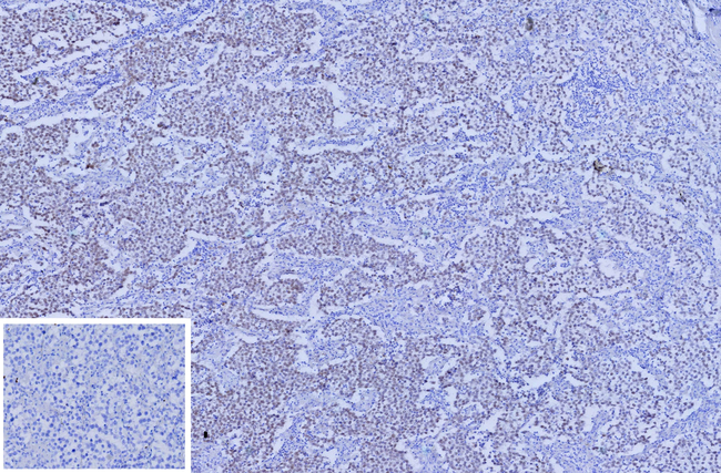 SALL-4 (Metastatic Germ Cell Tumor Marker) Antibody in Immunohistochemistry (Paraffin) (IHC (P))