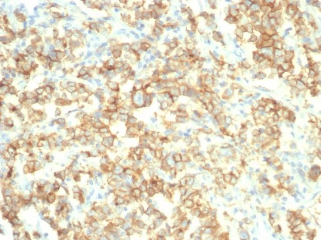 S100A14 (S100 calcium binding protein A14) Antibody in Immunohistochemistry (Paraffin) (IHC (P))