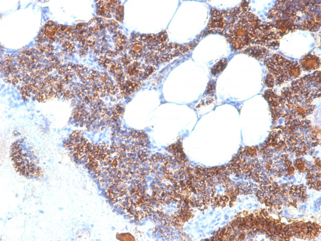 Parathyroid Hormone (PTH) Antibody in Immunohistochemistry (Paraffin) (IHC (P))