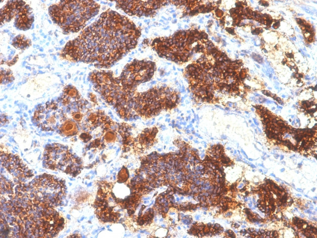 Parathyroid Hormone (PTH) Antibody in Immunohistochemistry (Paraffin) (IHC (P))