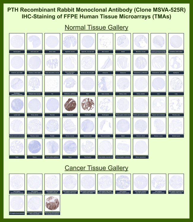 Parathyroid Hormone (PTH) (N-Terminal) Antibody in Immunohistochemistry (Paraffin) (IHC (P))