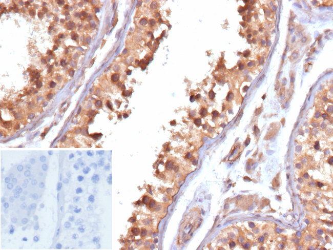Cycloxygenase-2 (COX-2) Antibody in Immunohistochemistry (Paraffin) (IHC (P))