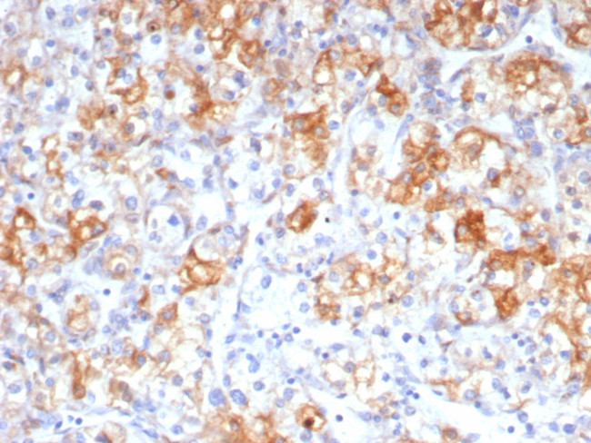 Cycloxygenase-2 (COX-2) Antibody in Immunohistochemistry (Paraffin) (IHC (P))