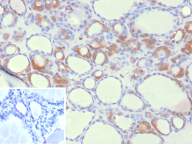 HEG1 (Marker of Malignant Mesothelioma) Antibody in Immunohistochemistry (Paraffin) (IHC (P))