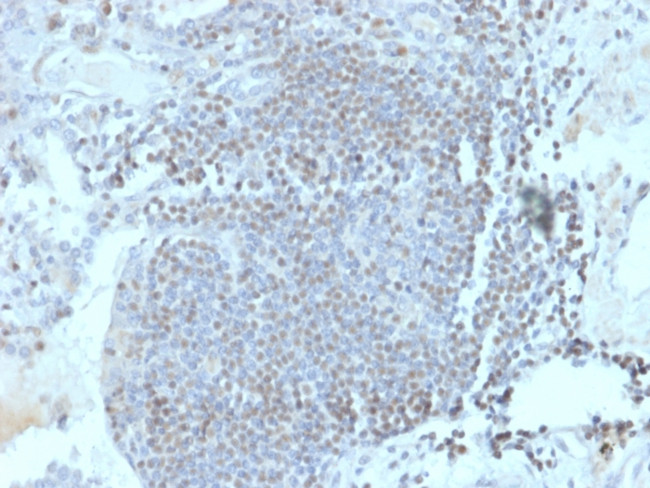 Homeobox and Leucine Zipper Encoding/HOMEZ Antibody in Immunohistochemistry (Paraffin) (IHC (P))