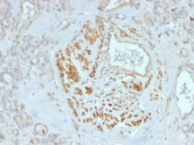 Homeobox and Leucine Zipper Encoding/HOMEZ Antibody in Immunohistochemistry (Paraffin) (IHC (P))