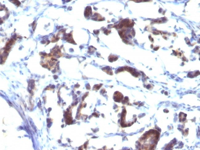 ZFYVE28 (Zinc Finger FYVE-type containing 28) Antibody in Immunohistochemistry (Paraffin) (IHC (P))