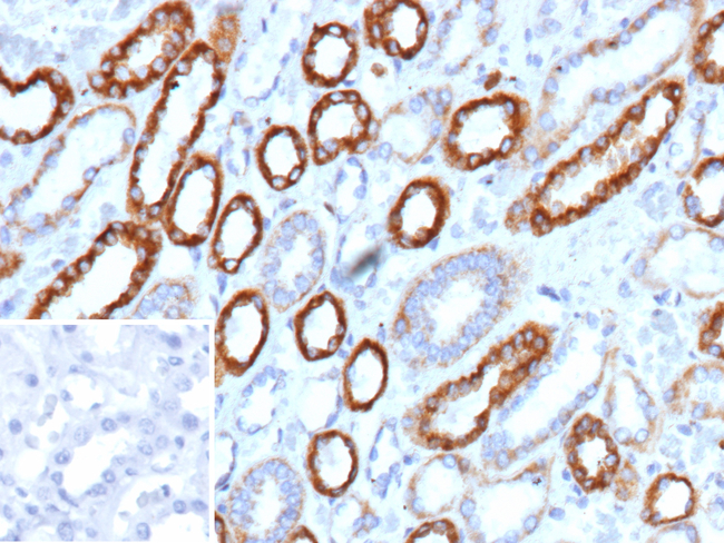 SLAMF7/CS1/CD319 (NK Cell Marker) Antibody in Immunohistochemistry (Paraffin) (IHC (P))