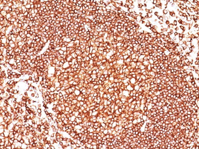 CD45/LCA (Leucocyte Marker) Antibody in Immunohistochemistry (Paraffin) (IHC (P))