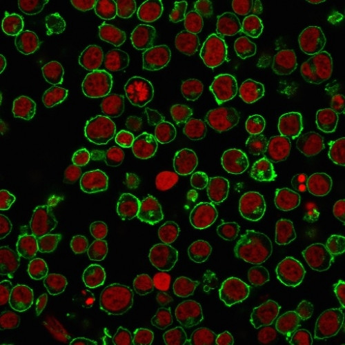 CD45/LCA (Leucocyte Marker) Antibody in Immunocytochemistry (ICC/IF)