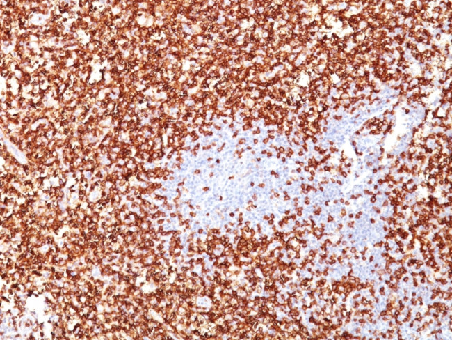 CD45RO (T-Cell Marker) Antibody in Immunohistochemistry (Paraffin) (IHC (P))