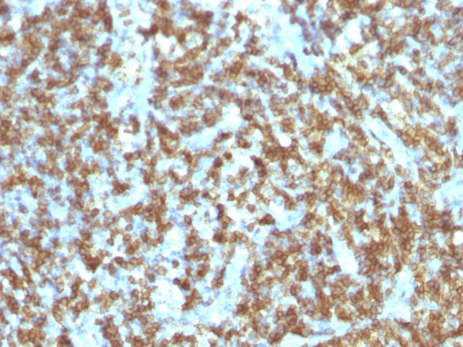 CD45RO (T-Cell Marker) Antibody in Immunohistochemistry (Paraffin) (IHC (P))