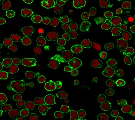 CD45/LCA (B-Cell Marker) Antibody in Immunocytochemistry (ICC/IF)