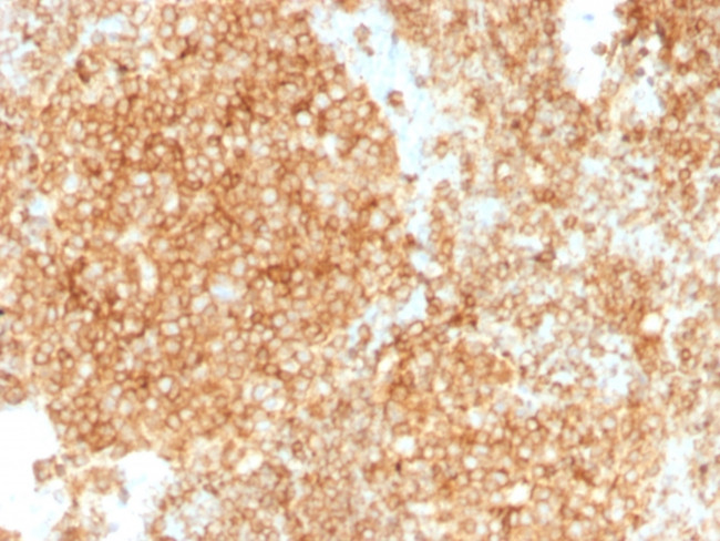 CD45/LCA Antibody in Immunohistochemistry (Paraffin) (IHC (P))