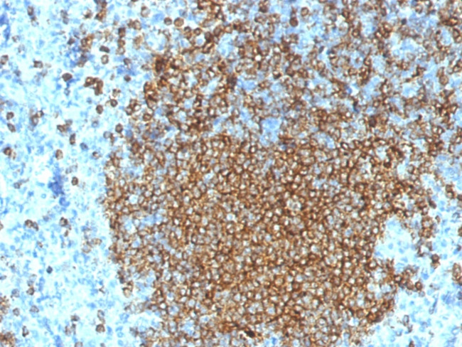 CD45RA (Leukocyte Marker) Antibody in Immunohistochemistry (Paraffin) (IHC (P))