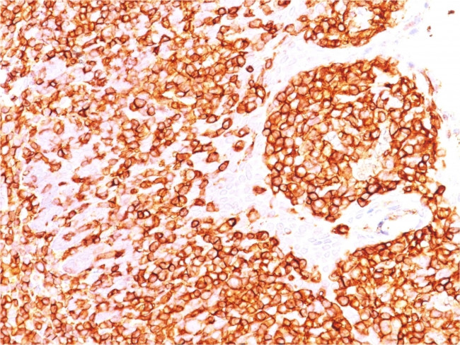 CD45/LCA Antibody in Immunohistochemistry (Paraffin) (IHC (P))