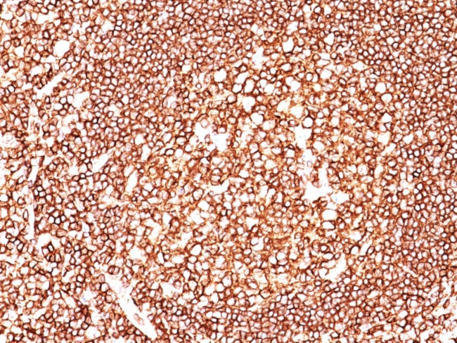 CD45/LCA (B-Cell Marker) Antibody in Immunohistochemistry (Paraffin) (IHC (P))