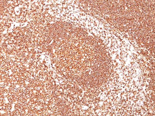 CD45/LCA (B-Cell Marker) Antibody in Immunohistochemistry (Paraffin) (IHC (P))