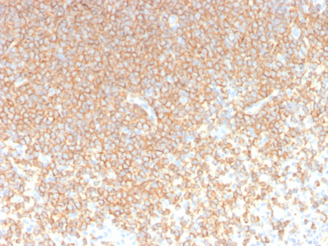 CD45RA Antibody in Immunohistochemistry (Paraffin) (IHC (P))