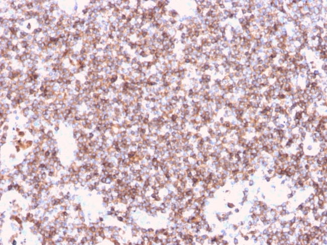 CD45/LCA Antibody in Immunohistochemistry (Paraffin) (IHC (P))