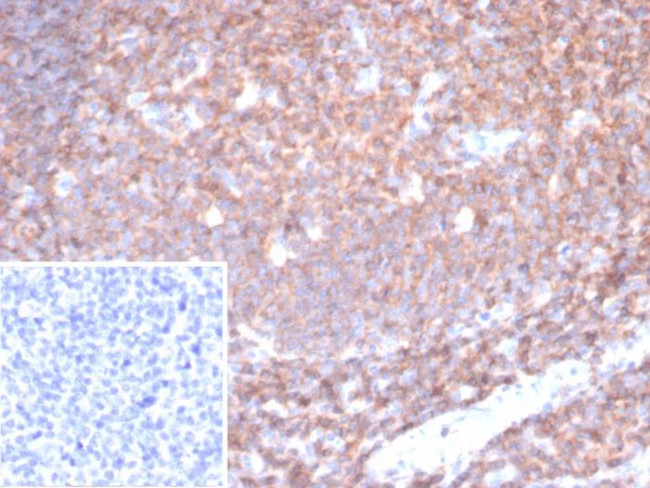 CD45/LCA (B-Cell Marker) Antibody in Immunohistochemistry (Paraffin) (IHC (P))