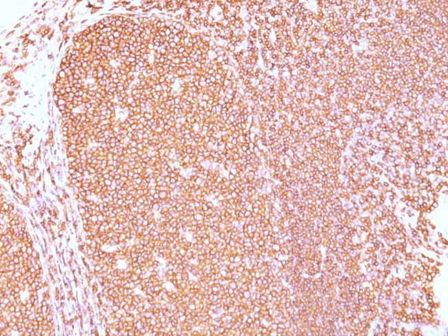 CD45RB (B-Cell Marker) Antibody in Immunohistochemistry (Paraffin) (IHC (P))