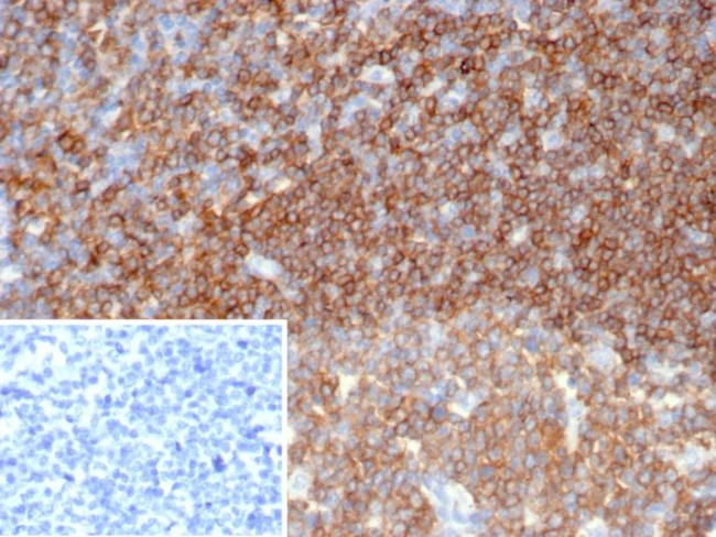 CD45/LCA (B-Cell Marker) Antibody in Immunohistochemistry (Paraffin) (IHC (P))