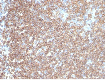 CD45RA/LCA (B-Cell Marker) Antibody in Immunohistochemistry (Paraffin) (IHC (P))