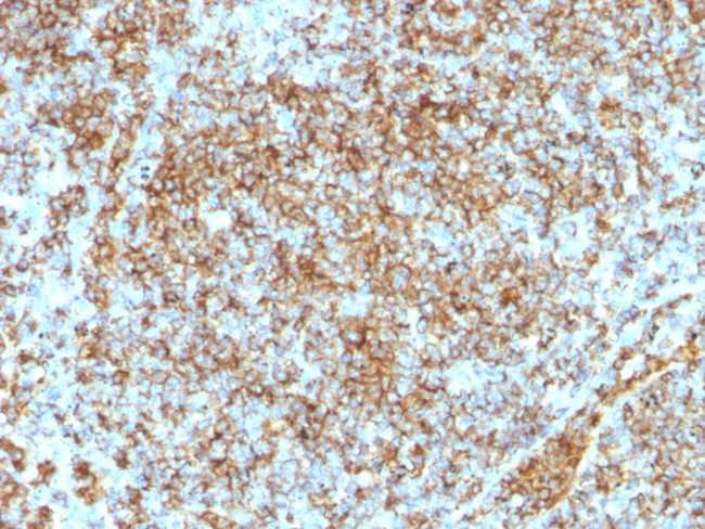 CD45RB (Leucocyte Marker) Antibody in Immunohistochemistry (Paraffin) (IHC (P))