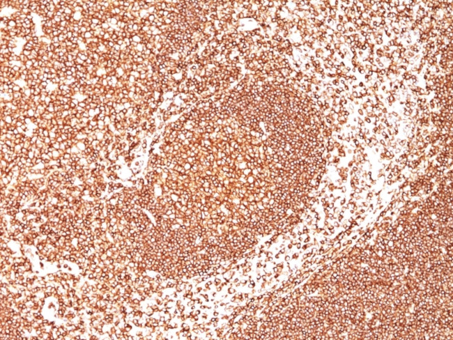 CD45/LCA (Leucocyte Marker) Antibody in Immunohistochemistry (Paraffin) (IHC (P))