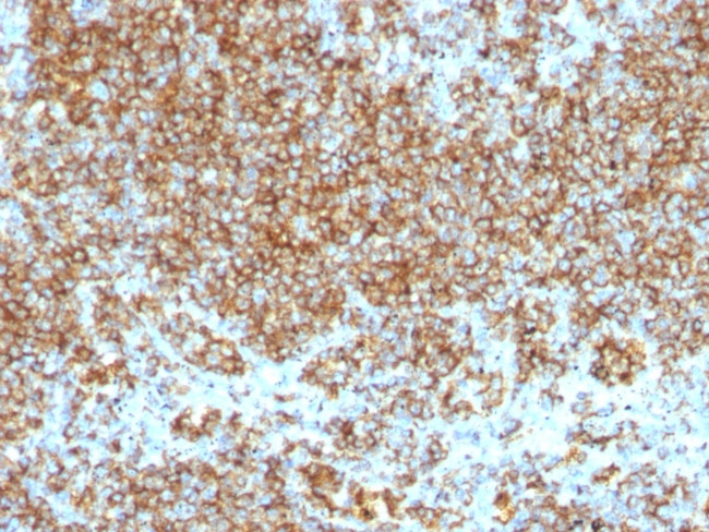 CD45/LCA (Leucocyte Marker) Antibody in Immunohistochemistry (Paraffin) (IHC (P))
