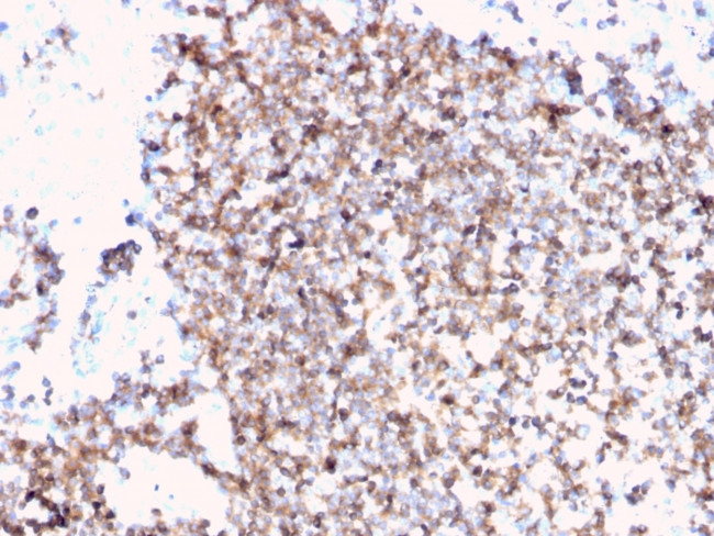 CD45/LCA Antibody in Immunohistochemistry (Paraffin) (IHC (P))