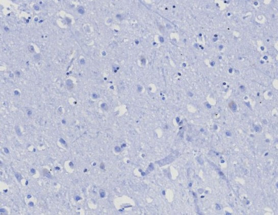 CD45RA/LCA (B-Cell Marker) Antibody in Immunohistochemistry (Paraffin) (IHC (P))