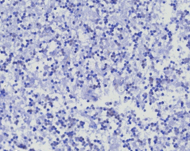 CD45RA/LCA (B-Cell Marker) Antibody in Immunohistochemistry (Paraffin) (IHC (P))