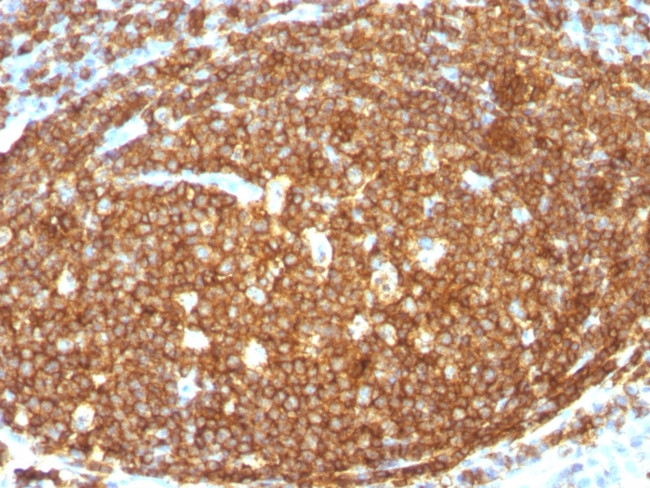 CD45RB (B-Cell Marker) Antibody in Immunohistochemistry (Paraffin) (IHC (P))