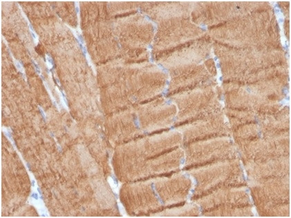 Actin alpha 1, Skeletal Muscle Antibody in Immunohistochemistry (Paraffin) (IHC (P))