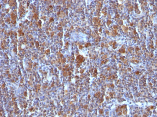 Bax Antibody in Immunohistochemistry (Paraffin) (IHC (P))
