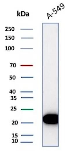 Bax (Apoptosis Marker) Antibody in Western Blot (WB)