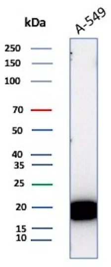 Bax (Apoptosis Marker) Antibody in Western Blot (WB)