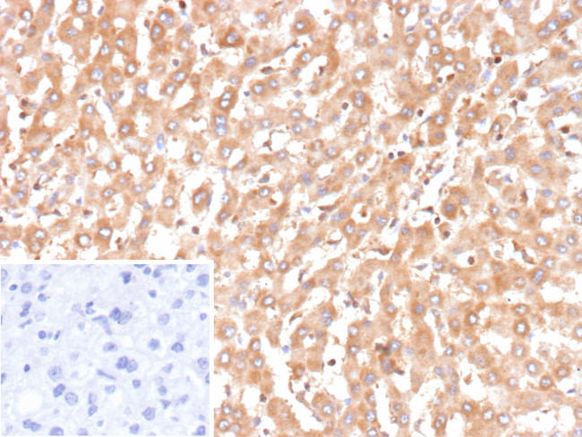 Bax (Apoptosis Marker) Antibody in Immunohistochemistry (Paraffin) (IHC (P))