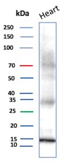 Parvalbumin/PVALB Antibody in Western Blot (WB)