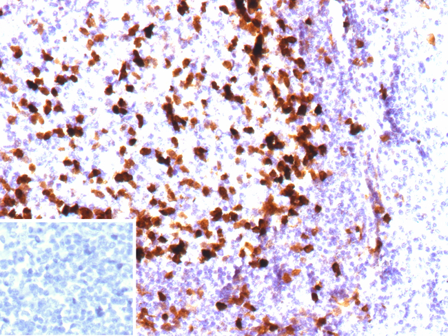 Parvalbumin/PVALB Antibody in Immunohistochemistry (Paraffin) (IHC (P))