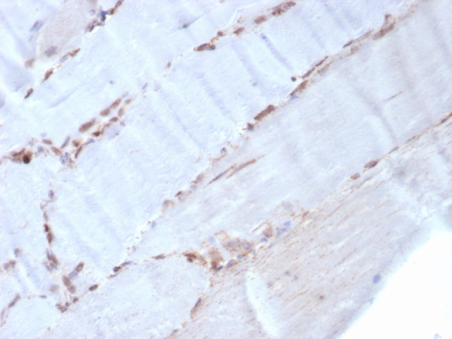 Actin, Smooth Muscle Antibody in Immunohistochemistry (Paraffin) (IHC (P))