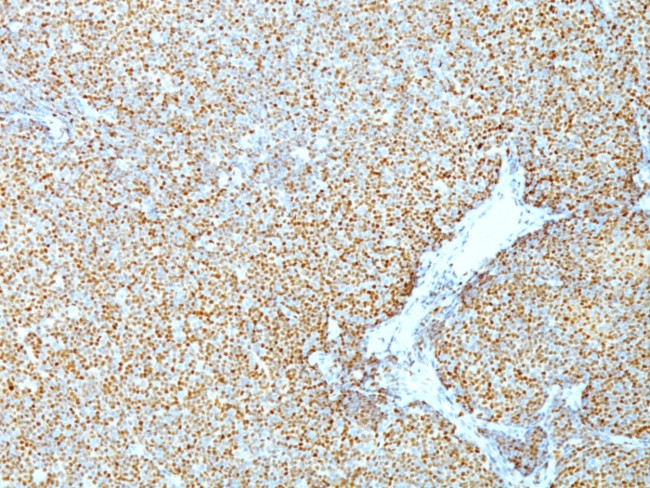Cyclin D1 (G1-Cyclin and Mantle Cell Marker) Antibody in Immunohistochemistry (Paraffin) (IHC (P))