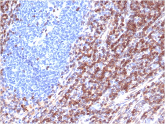 Bcl-2 Antibody in Immunohistochemistry (Paraffin) (IHC (P))