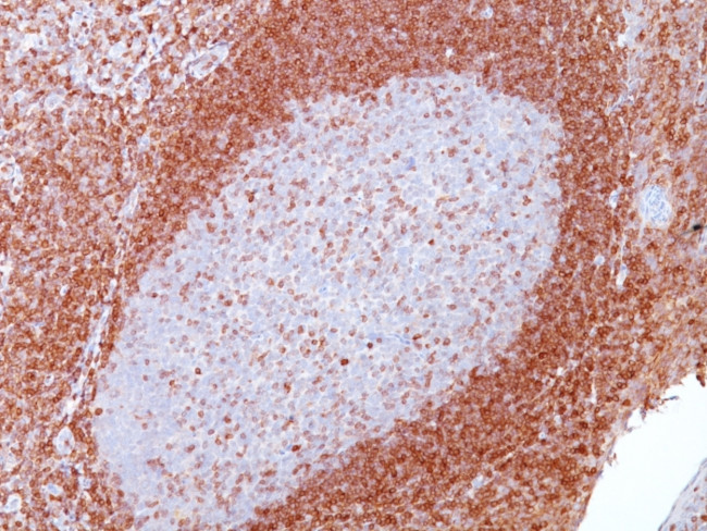 Bcl-2 (Apoptosis and Follicular Lymphoma Marker) Antibody in Immunohistochemistry (Paraffin) (IHC (P))